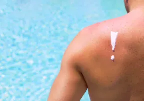 How to Care For Your Skin after a Sunburn
