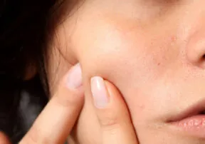 Improve Your Skin with these Five Nutrition Tips!