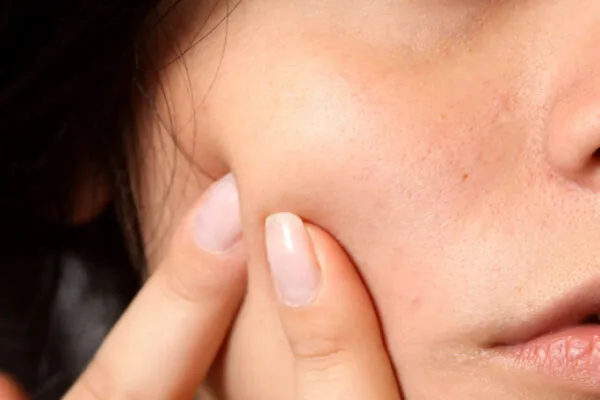 Improve Your Skin with these Five Nutrition Tips!