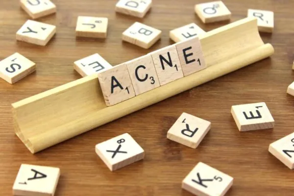 Keto Diet: A cure for Acne?