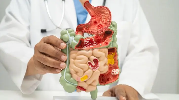 Doctor holding a model of a stomach